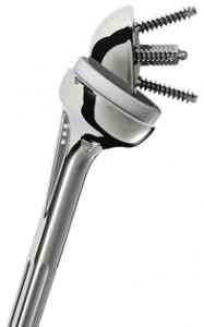 Inverse Schulterprothese Fa. Depuy